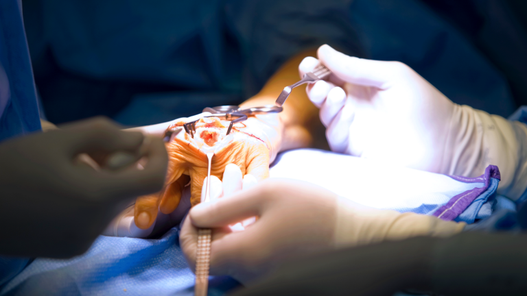 Chirurgischer Eingriff an Hand - Obere Extremität, Hand- und Mikrochirurgie - Immanuel Krankenhaus Berlin - Hand - Therapiemöglichkeiten