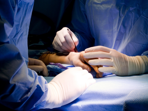 Arztteam operiert Hand - Obere Extremität - Immanuel Krankenhaus Berlin
