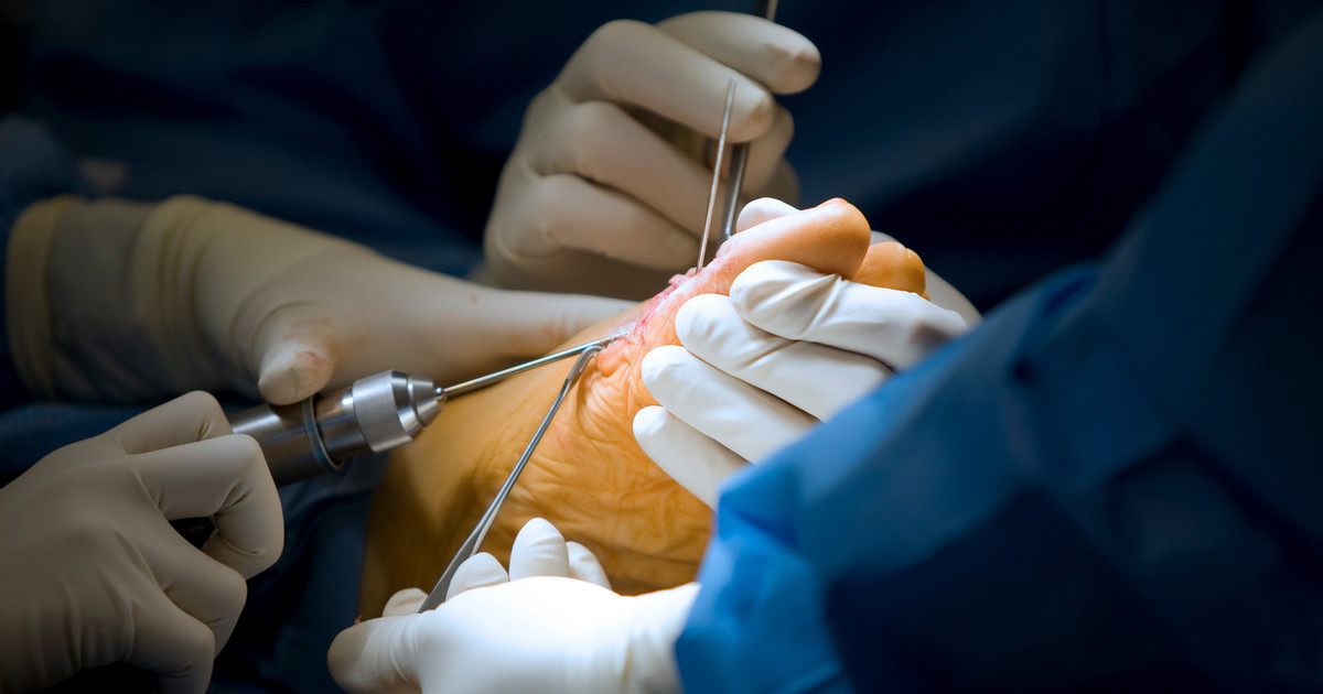 Ne Am Rind Chirurgie Am Fuss Des Rindes – Chirurgie Am Rind Anleitung – PBYB