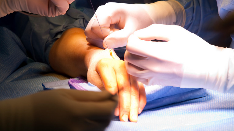 Hand wird während einer OP genäht - Immanuel Krankenhaus Berlin - Obere Extremität, Hand- und Mikrochirurgie - Leistungsspektrum - Mikrochirurgie